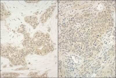 Immunohistochemistry-Paraffin: YY1 Antibody [NBP1-46218]