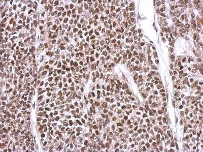 Immunohistochemistry-Paraffin: YY1 Antibody [NBP2-20932]