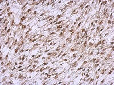Immunohistochemistry-Paraffin: YY1 Antibody [NBP2-20932]