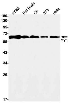 Western Blot: YY1 Antibody (S02-8A3) [NBP3-14987]