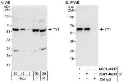 Western Blot: YY1 Antibody [NBP1-46218]