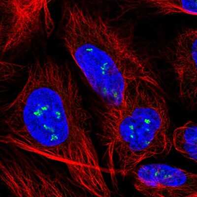 Immunocytochemistry/ Immunofluorescence: YY1AP1 Antibody [NBP2-57525]