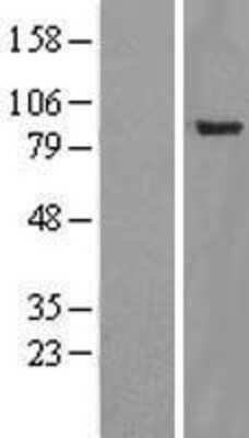 Western Blot: YY1AP1 Overexpression Lysate [NBL1-17954]