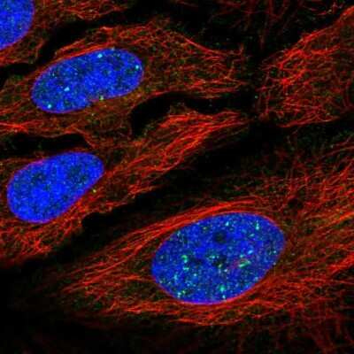 Immunocytochemistry/ Immunofluorescence: YY2 Antibody [NBP2-57462]