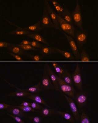 Immunocytochemistry/ Immunofluorescence: YY2 Antibody - Azide and BSA Free [NBP2-93905]
