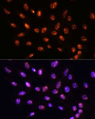 Immunocytochemistry/ Immunofluorescence: YY2 Antibody - Azide and BSA Free [NBP2-93905]
