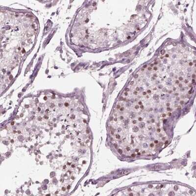 Immunohistochemistry-Paraffin: YY2 Antibody [NBP2-57462]