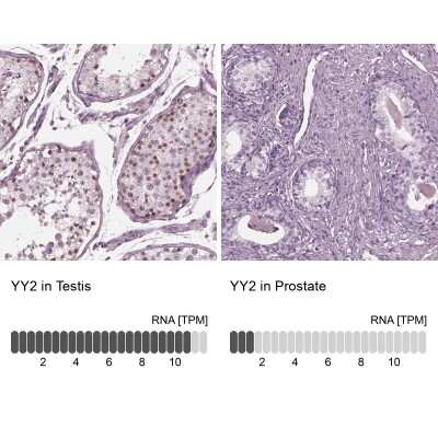 Immunohistochemistry-Paraffin: YY2 Antibody [NBP2-57462]