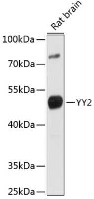 Western Blot: YY2 AntibodyAzide and BSA Free [NBP2-93905]