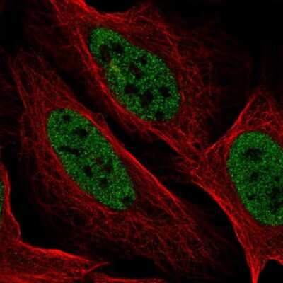 Immunocytochemistry/ Immunofluorescence: YdjC Homolog (Bacterial) Antibody [NBP2-57586]