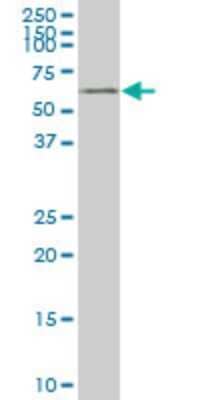 Western Blot: Yes Antibody (2A12) [H00007525-M05]