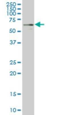 Western Blot: Yes Antibody (2D5) [H00007525-M03]