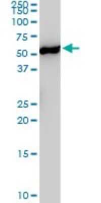 Western Blot: Yes Antibody (3C6) [H00007525-M02]