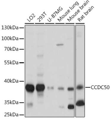 Western Blot: Ymer AntibodyAzide and BSA Free [NBP3-15552]