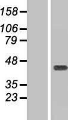 Western Blot: Ymer Overexpression Lysate [NBL1-08801]