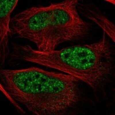 Immunocytochemistry/ Immunofluorescence: ZA20D3 Antibody [NBP3-17456]