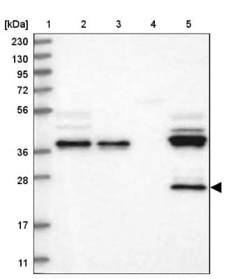 Western Blot: ZA20D3 Antibody [NBP1-90060]