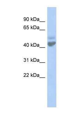 Western Blot: ZACN Antibody [NBP1-80104]