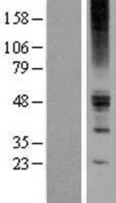 Western Blot: ZACN Overexpression Lysate [NBP2-04942]