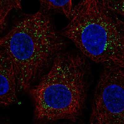 Immunocytochemistry/ Immunofluorescence: ZADH1 Antibody [NBP2-38122]