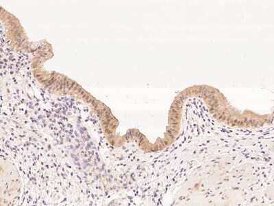 Immunohistochemistry: ZADH1 Antibody [NBP3-06247]