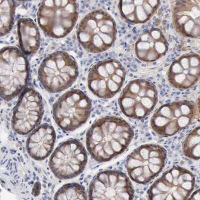 Immunohistochemistry-Paraffin: ZADH1 Antibody [NBP2-38122]