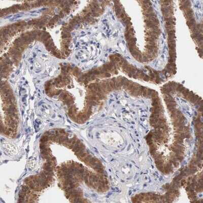 Immunohistochemistry-Paraffin: ZADH1 Antibody [NBP2-38122]