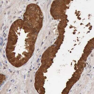 Immunohistochemistry-Paraffin: ZADH1 Antibody [NBP2-38122]