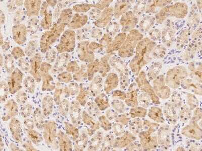 Immunohistochemistry-Paraffin: ZADH1 Antibody [NBP3-06247]