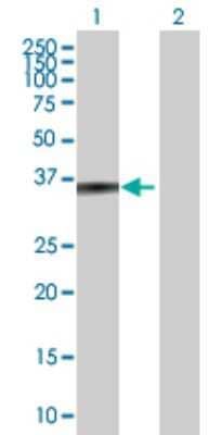 Western Blot: ZADH1 Antibody [H00145482-B01P]