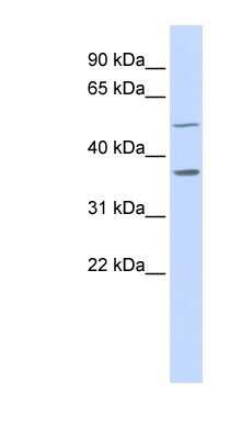 Western Blot: ZADH1 Antibody [NBP1-55192]