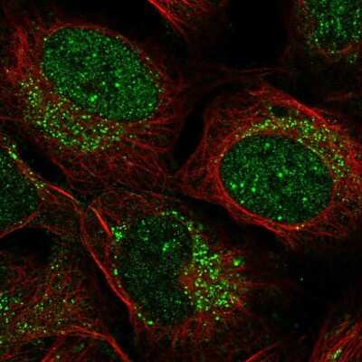 Immunocytochemistry/ Immunofluorescence: ZADH2 Antibody [NBP2-58448]