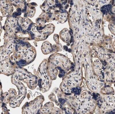 Immunohistochemistry-Paraffin: ZADH2 Antibody [NBP1-82679]