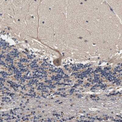 Immunohistochemistry-Paraffin: ZADH2 Antibody [NBP1-82679]