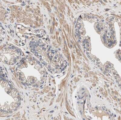 Immunohistochemistry-Paraffin: ZADH2 Antibody [NBP1-82679]