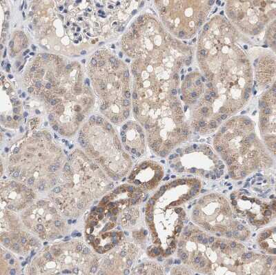 Immunohistochemistry-Paraffin: ZADH2 Antibody [NBP1-82679]