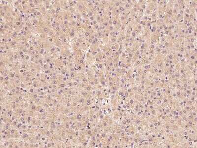 Immunohistochemistry-Paraffin: ZADH2 Antibody [NBP2-98567]