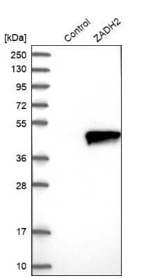 Western Blot: ZADH2 Antibody [NBP1-82679]