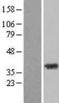 Western Blot: ZADH2 Overexpression Lysate [NBL1-17955]