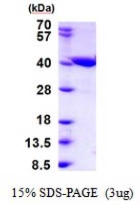 SDS-PAGE: Recombinant Human ZADH2 His Protein [NBP2-51863]