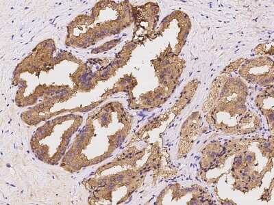 Immunohistochemistry-Paraffin: ZAG Antibody [NBP2-97955]