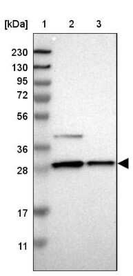 Western Blot: ZAG Antibody [NBP1-86842]