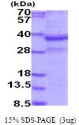 SDS-PAGE: Recombinant Human ZAG His Protein [NBP2-51964]