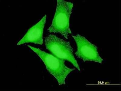 Immunocytochemistry/ Immunofluorescence: ZAK Antibody (2G7) [H00051776-M09]