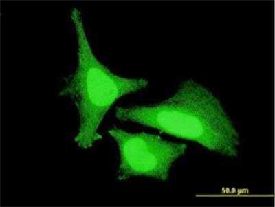 Immunocytochemistry/ Immunofluorescence: ZAK Antibody (3B6) [H00051776-M05]