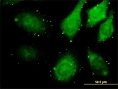 Immunocytochemistry/ Immunofluorescence: ZAK Antibody (3D11) [H00051776-M02]