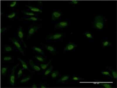 Immunocytochemistry/ Immunofluorescence: ZAK Antibody (3G5) [H00051776-M03]