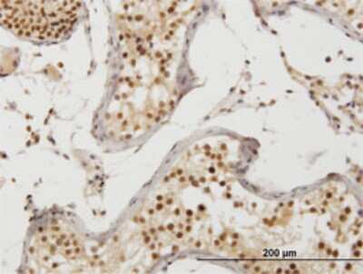 Immunohistochemistry-Paraffin: ZAK Antibody (3G5) [H00051776-M03]