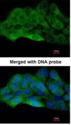 Immunocytochemistry/ Immunofluorescence: ZAK Antibody [NBP1-33137]