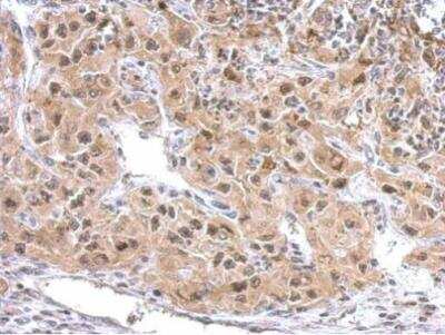 Immunohistochemistry-Paraffin: ZAK Antibody [NBP1-33137]